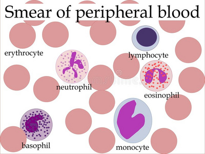 外周血涂片