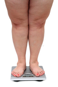 超重女性腿部