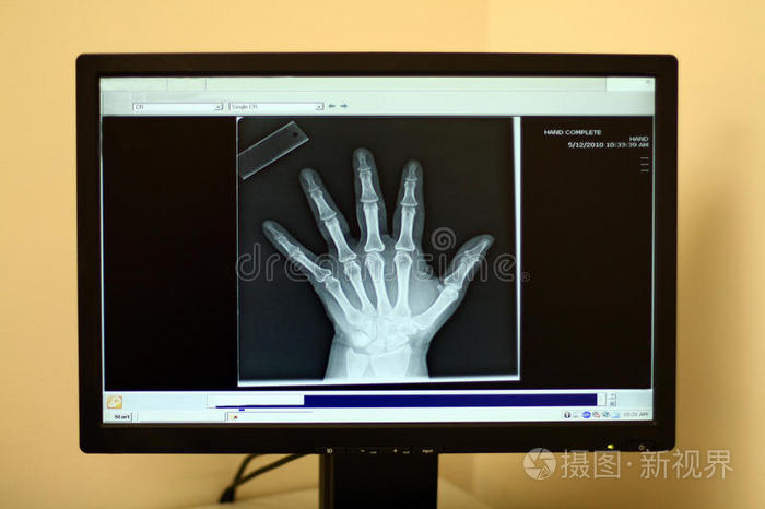 x光片手部x光片现代人体手部x光显示特写x射线手用循环系统解剖人的