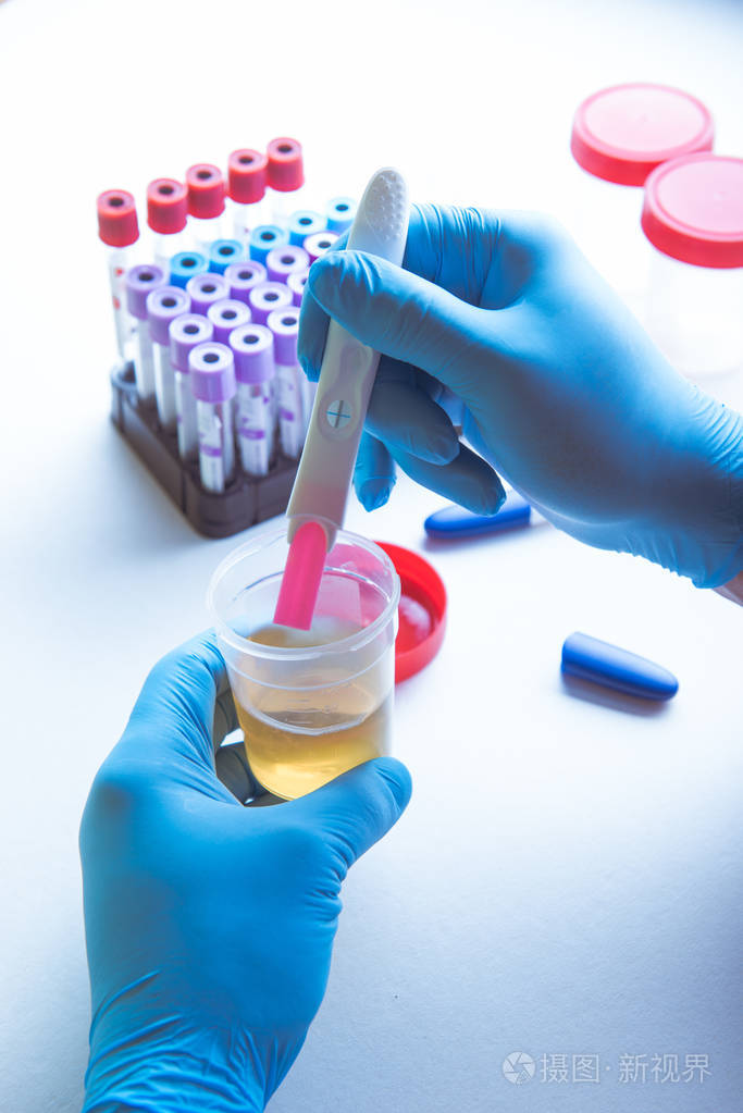 妊娠试验 hcg 实验室研究
