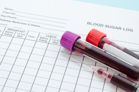 日常血糖登录测试和样本血液管和 syrin
