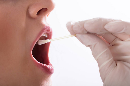 牙医手拿棉签从女人嘴里取唾液检验
