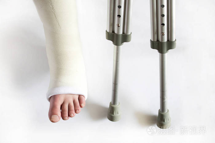 在石膏和拐杖的腿
