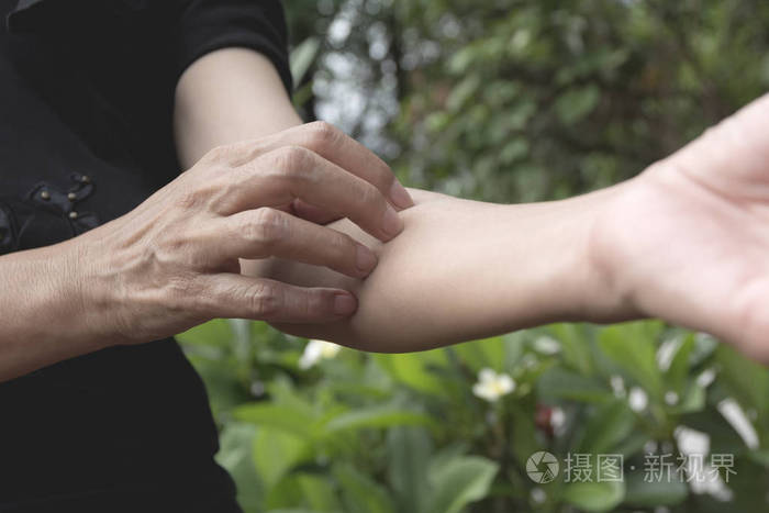 女人用手抓痒.女人抓她的手臂医疗保健理念