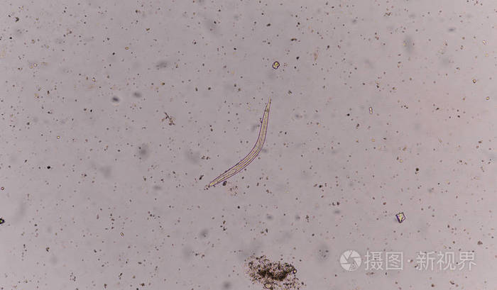粪便中粪类圆线虫threadworm