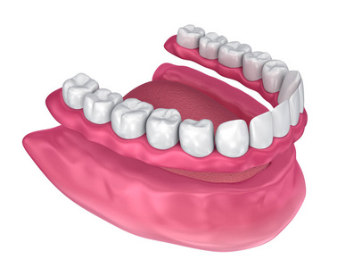 所有缺牙可拆卸全口义齿。3d 插图