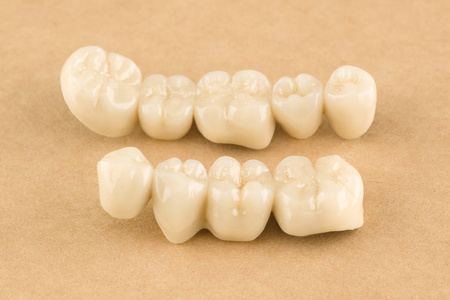 牙列修复用陶瓷人工牙科结构的研究