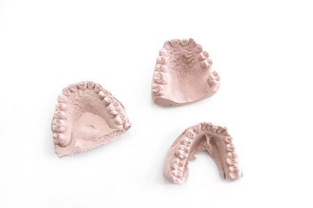 义齿模型在牙科诊所