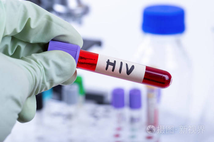 手中拿着管与hiv检测的血液样本