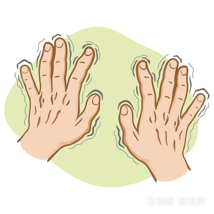 关闭身体的一部分,双手颤抖症状的帕金森病 感冒或恐惧,白种人.