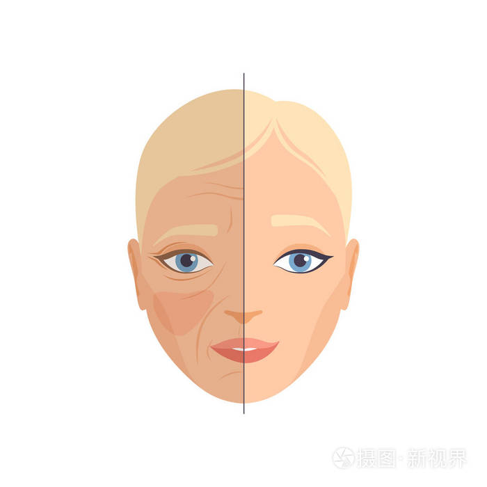整容前后女性脸的面部恢复,美容及抗衰老概念向量图解