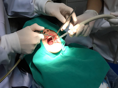 孩子嘴里检查在牙科诊所