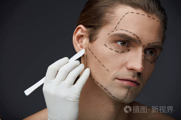 整形外科手术前脸上的黑色线条的男人