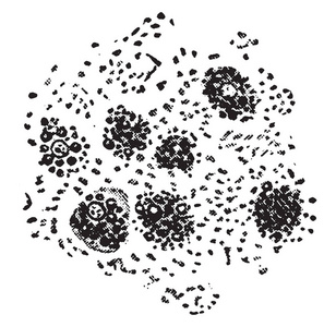 肝细胞脂肪, 复古雕刻插图