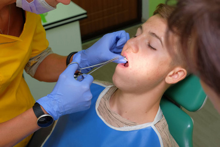 医生用特制的钳子在青少年牙齿上贴上括号。