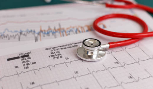 医疗保健概念医用听诊器心跳和心电图
