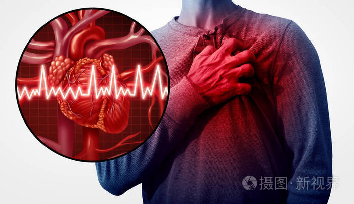 人的心脏攻击痛苦作为解剖学医学疾病概念与人遭受心脏病作为痛苦冠状