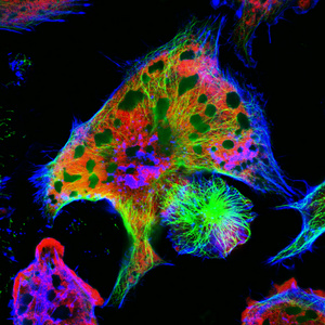小鼠真正的荧光小鼠神经母细胞瘤细胞系的微观角度照片