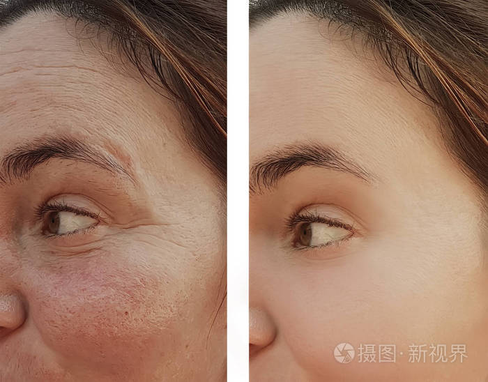 化妆前后眼部妇女脸上的皱纹