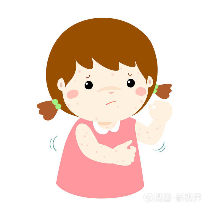 女孩在他身体矢量挠发痒的皮疹