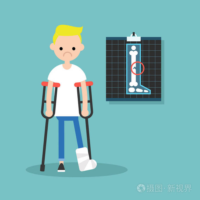 残疾的金发男孩,拄着拐杖与断腿 可编辑矢量