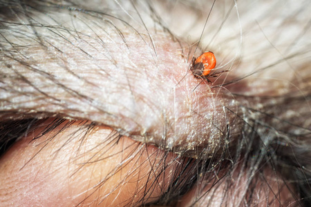 一个橙色的蜱在宠物的皮肤上, 和人类的手指指向