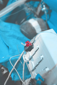 患者在操作桌连接到呼吸机和另一个数字设备