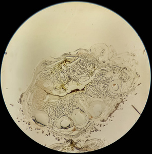 显微镜下小鼠腿组织免疫组化的组织学剖面研究显微摄影的形式和动物的临床前实验照片