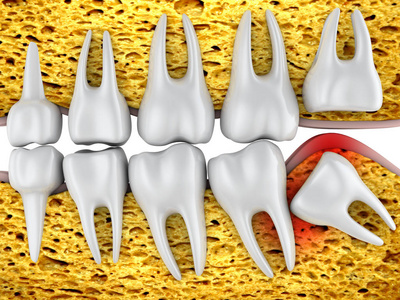 牙科排磨牙和不正确定位智齿。3d 渲染