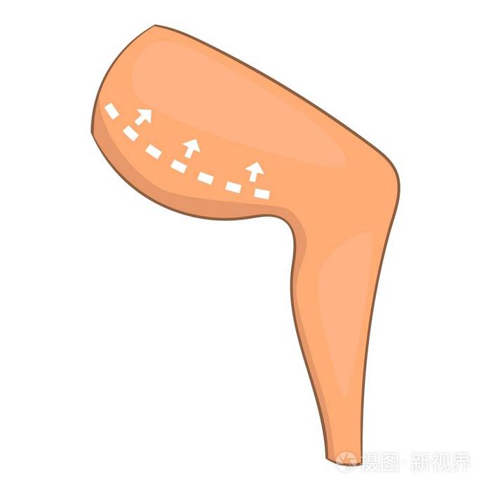 大腿手术矫正图标卡通风格