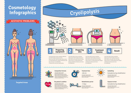 矢量插图集美容 Cryolipolysis 治疗