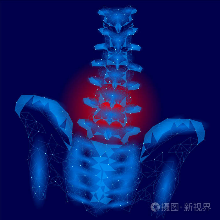 人脊柱髋关节性痛低聚.