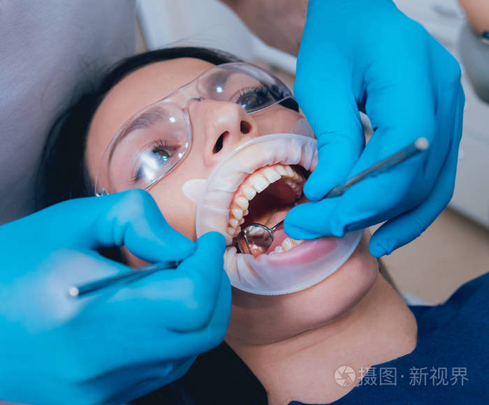 扩张器牙科治疗.