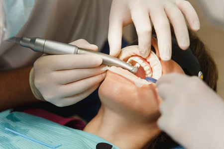 关闭牙科陶瓷冠的准备和安装过程。男性专业牙医帮助治疗妇女患者的牙齿在诊所光办公室与现代工具设备。张开嘴