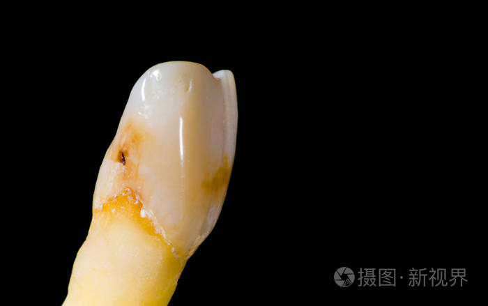 牙齿隔离在黑色