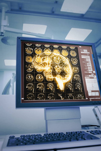 医学监护仪的人脑 Ct 投影