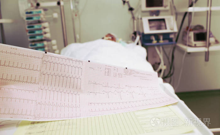 icu 危重病人的心电图照片-正版商用图片10s6tw-摄图新视界