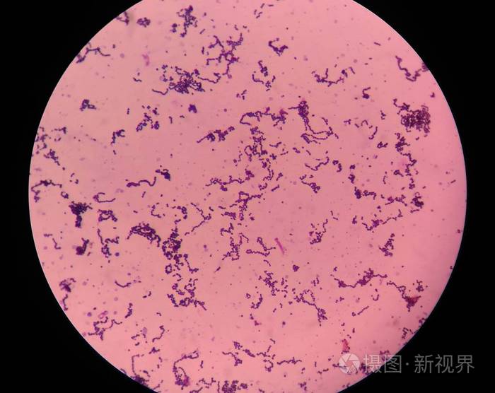 用显微镜发现细菌细胞