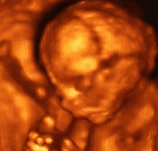 意大利第4个月胎儿超声分析