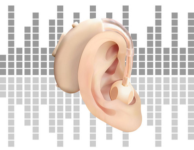 数字听觉辅助耳后, 在声波图的背景下。耳鼻咽喉听觉丧失的治疗和修复。现实的向量例证。医药卫生
