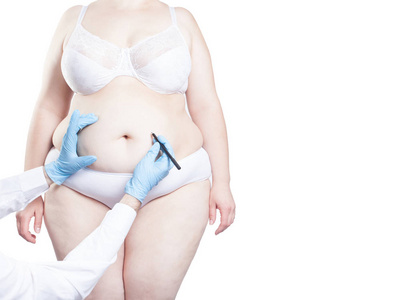 s belly for plastic surgery. Weight loss concept.  isolated on 