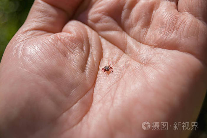 蜱虫在人类皮肤上爬行脑炎蜱这种动物是硼菌的分布者