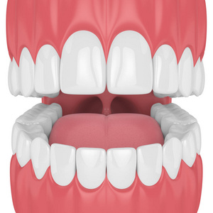 牙颌三维渲染。 牙科保健概念。