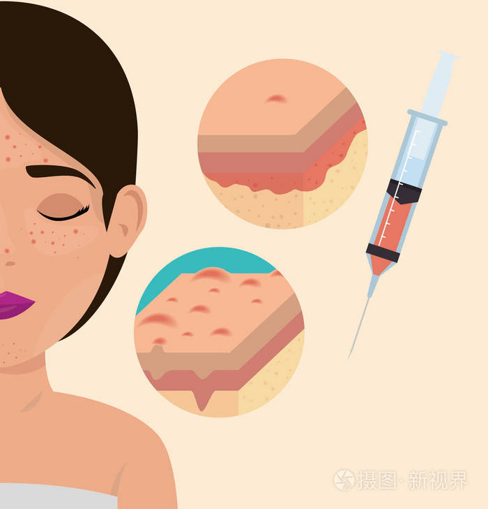 肉毒杆菌治疗妇女