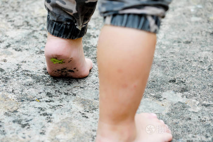 赤脚:小孩的脚不要穿鞋在混凝土地板上