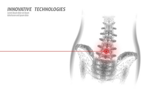 人脊柱髋部腰椎 radiculitis 疼痛低聚。几何多边形粒子三角形点线未来医学技术白红色疼痛区域向量例证