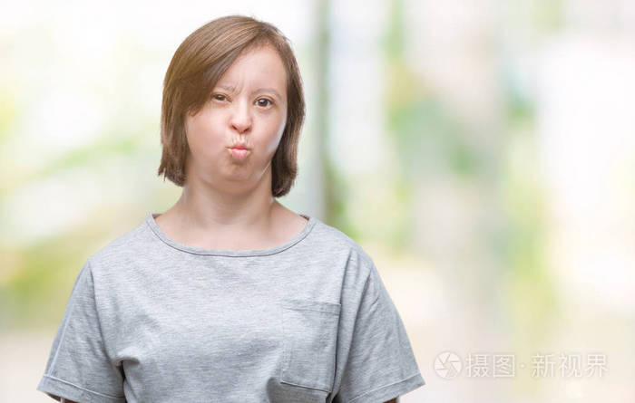 年轻的成年妇女患有唐氏综合症,孤立的背景,肿胀的脸颊,滑稽的脸.