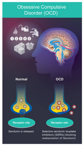 强迫症OCD。 需要反复检查事物的精神症状。病人在做某事时无法控制他们的行为和想法。