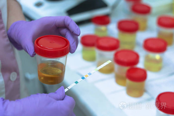 临床医学实验室尿液检查.