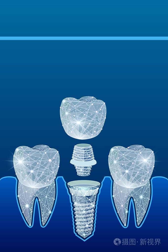 健康的牙齿和种植牙牙科人类牙齿的植入多边形线框从点和线抽象设计